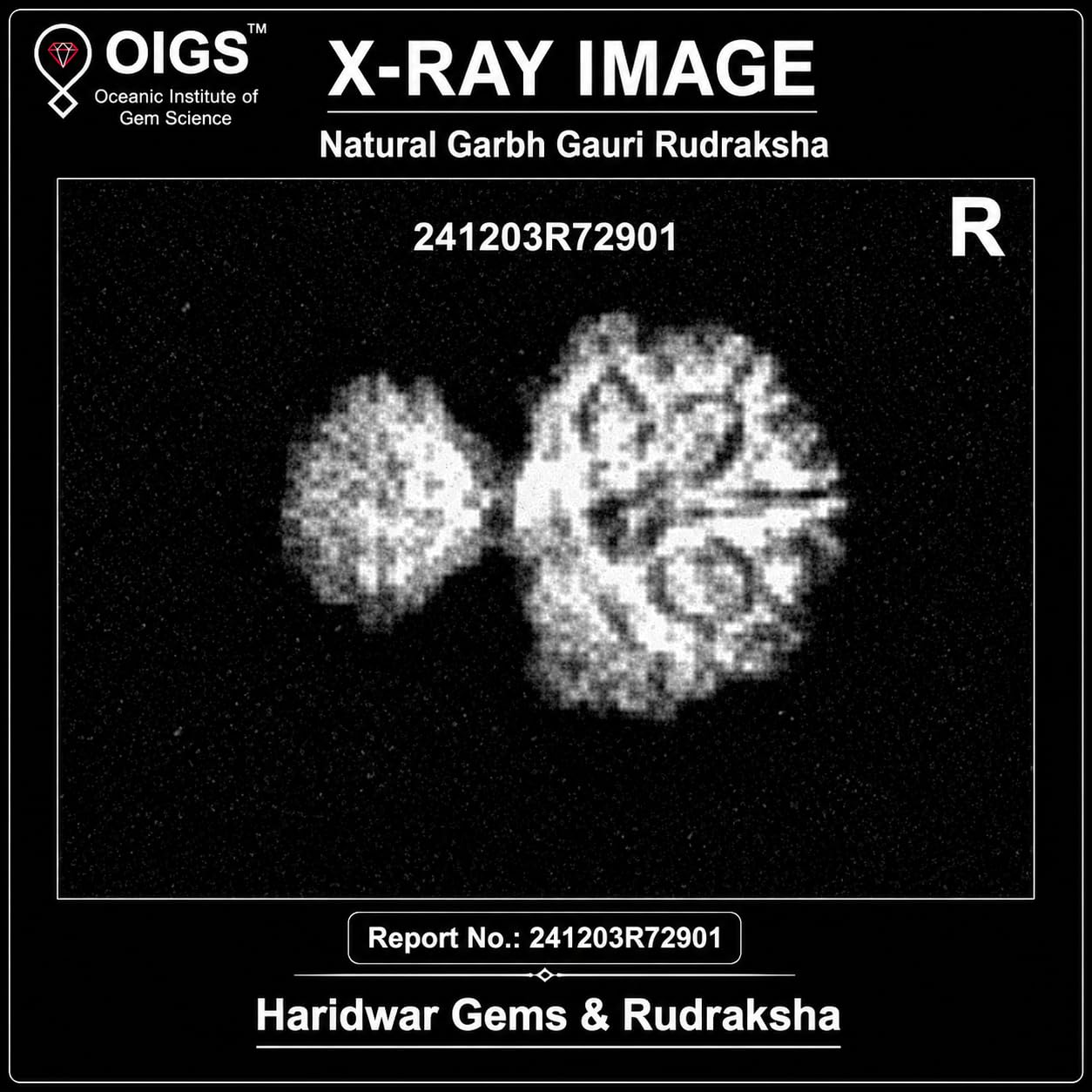 Garbh Gauri Rudraksha: Fertility & Pregnancy Protection -2 Garbh Gauri Rudraksha: Fertility & Pregnancy Protection -2