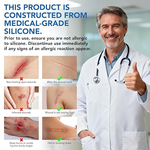 Miniatura 7 de Hojas de silicona para cicatrices, cinta adhesiva de silicona (rollo de 1.6 x 60 pulgadas - 4.9 ft), cinta adhesiva reutilizable, suave y de grado