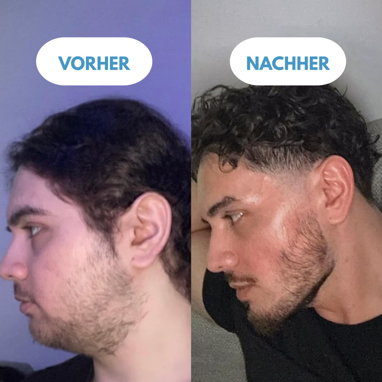 clear & lift,Gesichtsmassagegerät, 7 LED Lichtmodelle & 45°C Konstante Erwärmung, EMS Elektrisch V Shape Facial Lift, Gua Sha Face Massager