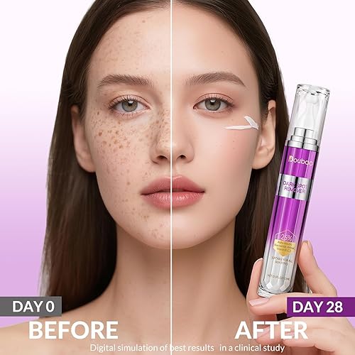 Miniatura 3 de Eliminador de manchas oscuras para cara y cuerpo, suero corrector de pecas de manchas de edad, tratamiento de melasma para cara, crema avanzada de