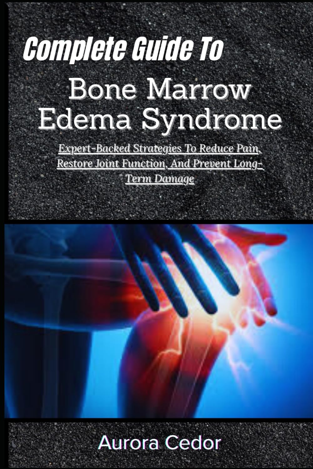 Complete Guide To Bone Marrow Edema Syndrome: Expert-Backed Strategies To Reduce Pain, Restore Joint Function, And Prevent Long-Term Damage