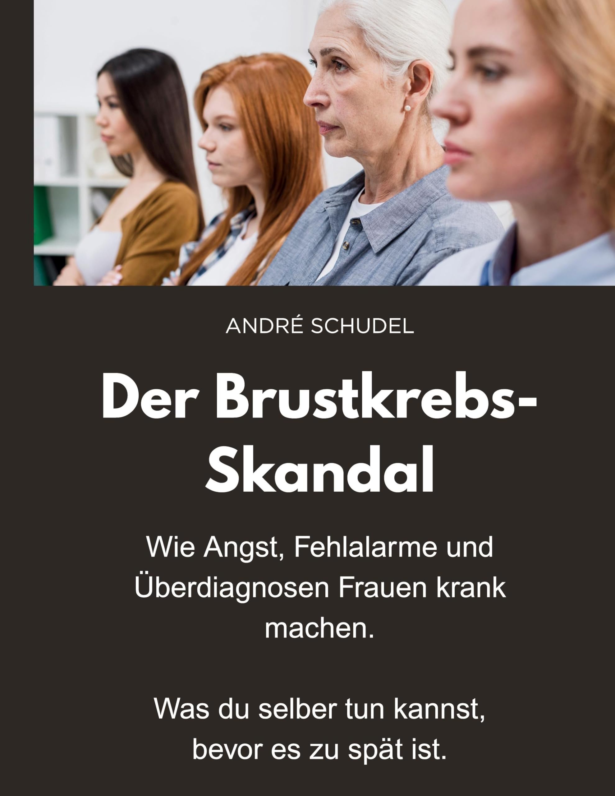Der Brustkrebs-Skandal - Wie Angst, Fehlalarme und Überdiagnosen Frauen krank machen - Was du selber tun kannst, bevor es zu spät ist.: Ein Mutmacherbuch für Frauen.