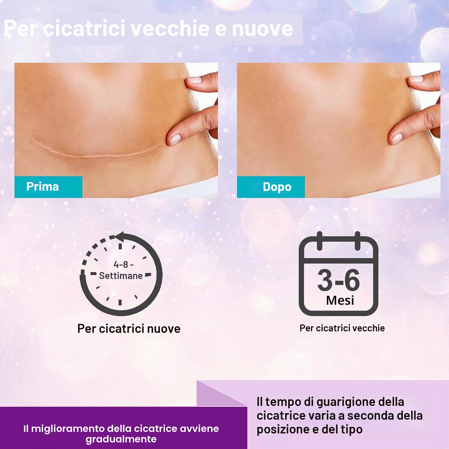 1.5M Fogli di silicone cicatrici 6 mesi di fornitura