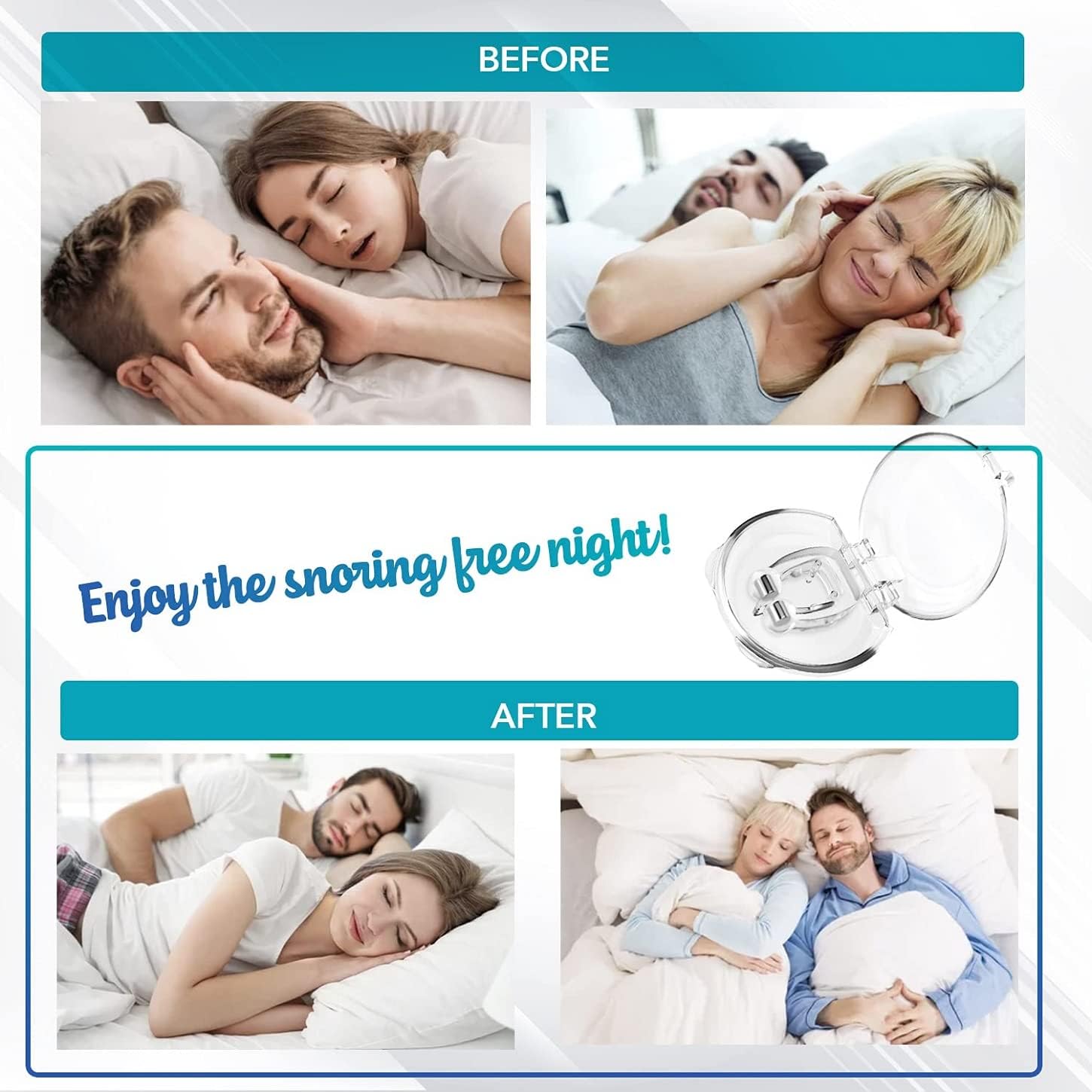 Skyloa Anti Snoring Devices