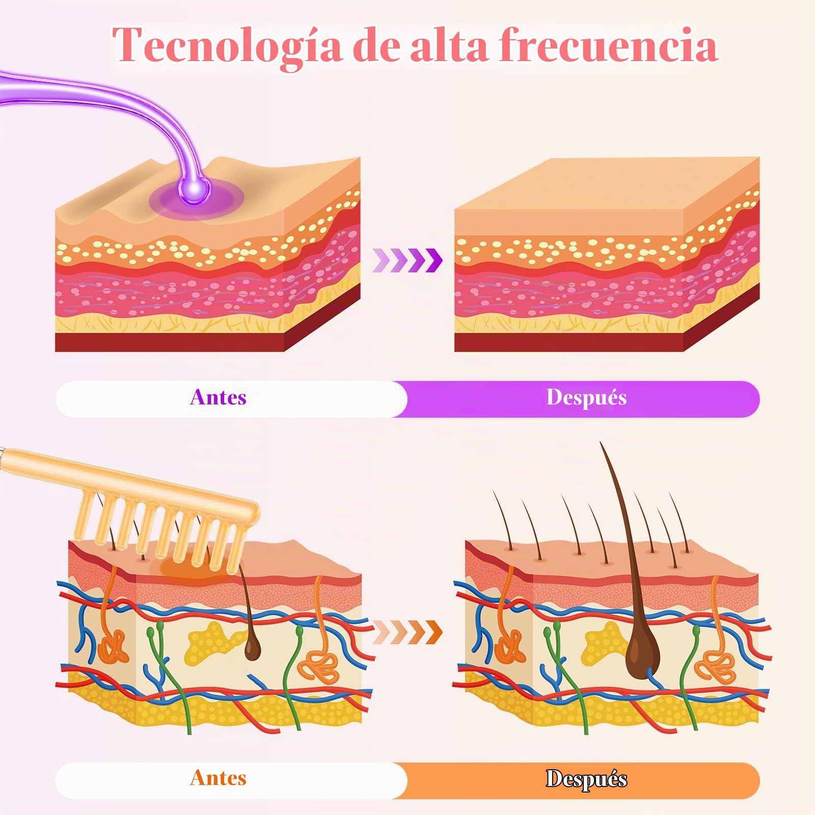 Alta Frecuencia Capilar, iklestar Máquina de Alta Frecuencia Facial para el Crecimiento del Cabello con 6 Tubos de Vidrio, Kit de Varita Manual para Uso en Casa