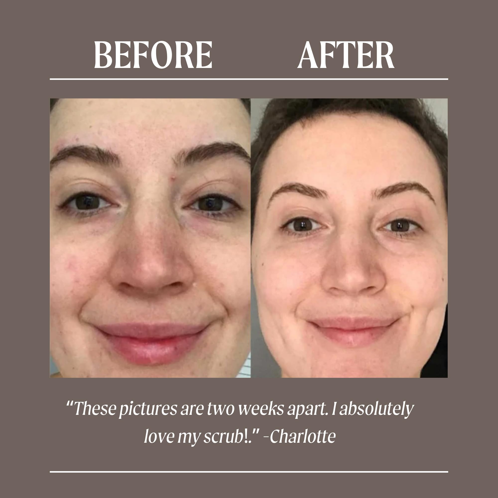 UpCircle Coffee Face Scrub - mieszanka cytrusów do skóry normalnej i suchej 100 ml - masło shea, olej kokosowy + olejek z dzikiej róży - naturalny, wegański peeling do twarzy dla miękkiej, gładkiej