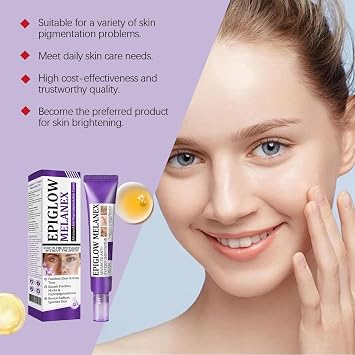 Dark spot remover for face, age spot remover reduces the appearance of old & new scars, melasma treatment cream for face, pigmentation freckles removal cream (30g, 3)