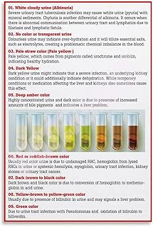 Propofol's Impact On Urine: Color Change And More | MedShun