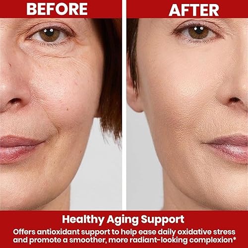 Vista 4 de Suplemento líquido NAD+ de 1000 mg 850 mg de ribósido de nicotinamida con resveratrol, quercetina, CoQ10 y biotina Energía celular, reparación