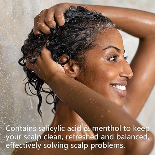 Miniatura 6 de Champú anticaspa de 10.1 fl oz, champú anticaspa, cuidado del cabello, control de aceite para hombres y mujeres (1 unidad)