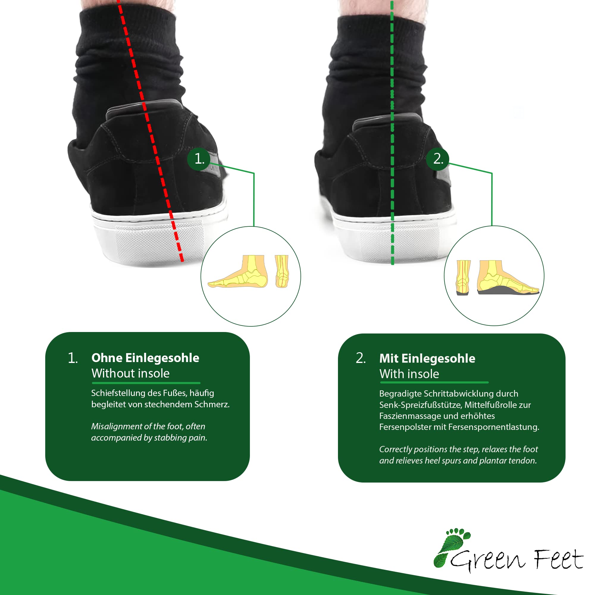 GreenFeet orthopedische inlegzolen. knikvoet verzonken voet