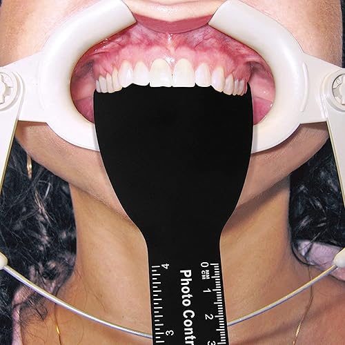 Miniatura 4 de PROTECTOR Kit de contraste de fotos dentales de 6 piezas de contratista dental fotográfico dental negro