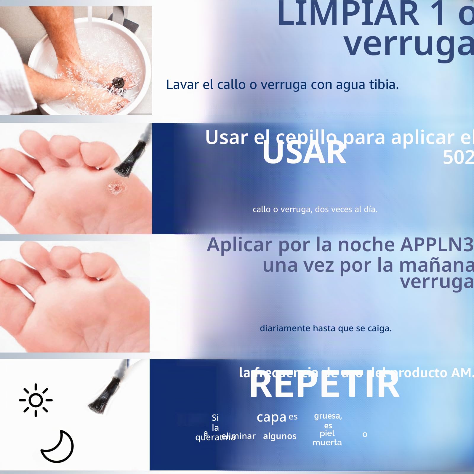 MYMULIKE Liquid WART&CORN REMOVER, 15 ml Wart Remover, Solución contra callos y callosidades, eliminador de verrugas, alivio del dolor de maíz y cuidado de los pies, eliminación de verrugas