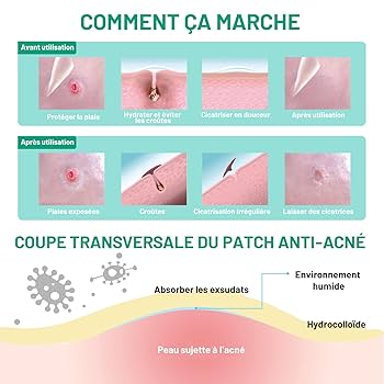 Quand consulter un ‌professionnel pour un​ bouton récalcitrant