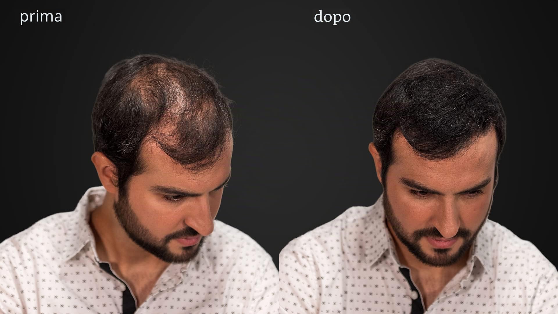 LUXE Fibre ispessimento capelli con cheratina naturale - Dura 2 mesi! - Testato da dermatologi – Ipoallergenico - Molteplici colori disponibili. Castano scuro