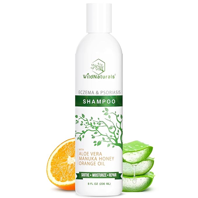 Psoriasis Shampoo for Scalp Care - Anti Dandruff and Dry Scalp Shampoo - Gentle Itchy Scalp Shampoo - Hydrating Scalp Psoriasis Shampoo for Itchy Scalp Treatment - Anti Dandruff and Dry Scalp Shampoo - Gentle Itchy Scalp Shampoo