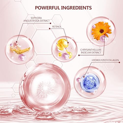 Miniatura 2 de Yargkos 60 parches rosas para debajo de los ojos, 30 pares de máscaras debajo de los ojos para ojos hinchados, tratamiento de ojeras, almohadillas