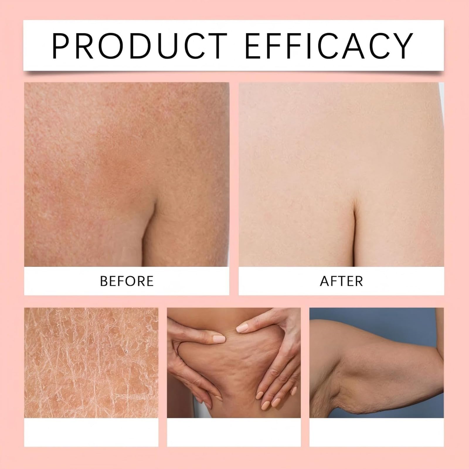 Skincu Glow Remedy Körperöl 100 Ml,Hautglättendes Massageöl Für Alle Gängigen Hauttypen,Leichtes,Nicht Fettendes,Schnell Einziehendes Feuchtigkeitsöl Für Frauen Und Männer (3pcs)