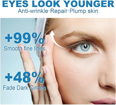 Chalazion Eye Treatment Cream, Soothing Eye Stye Treatment for Swollen Eyelids, Dry Eyes, Dark Circles and Puffiness, Gentle Blepharitis Treatment Eye Care Moisturizer for Stye