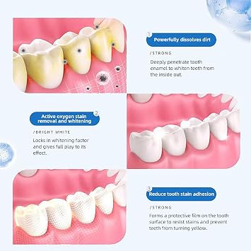 Teeth Whitening Stripes - Teeth Whitening Strips White Stripes for Teeth Whitening Teeth White Stripes Teeth Safe for Enamel 28 Whitening Stripes Teeth Bleaching