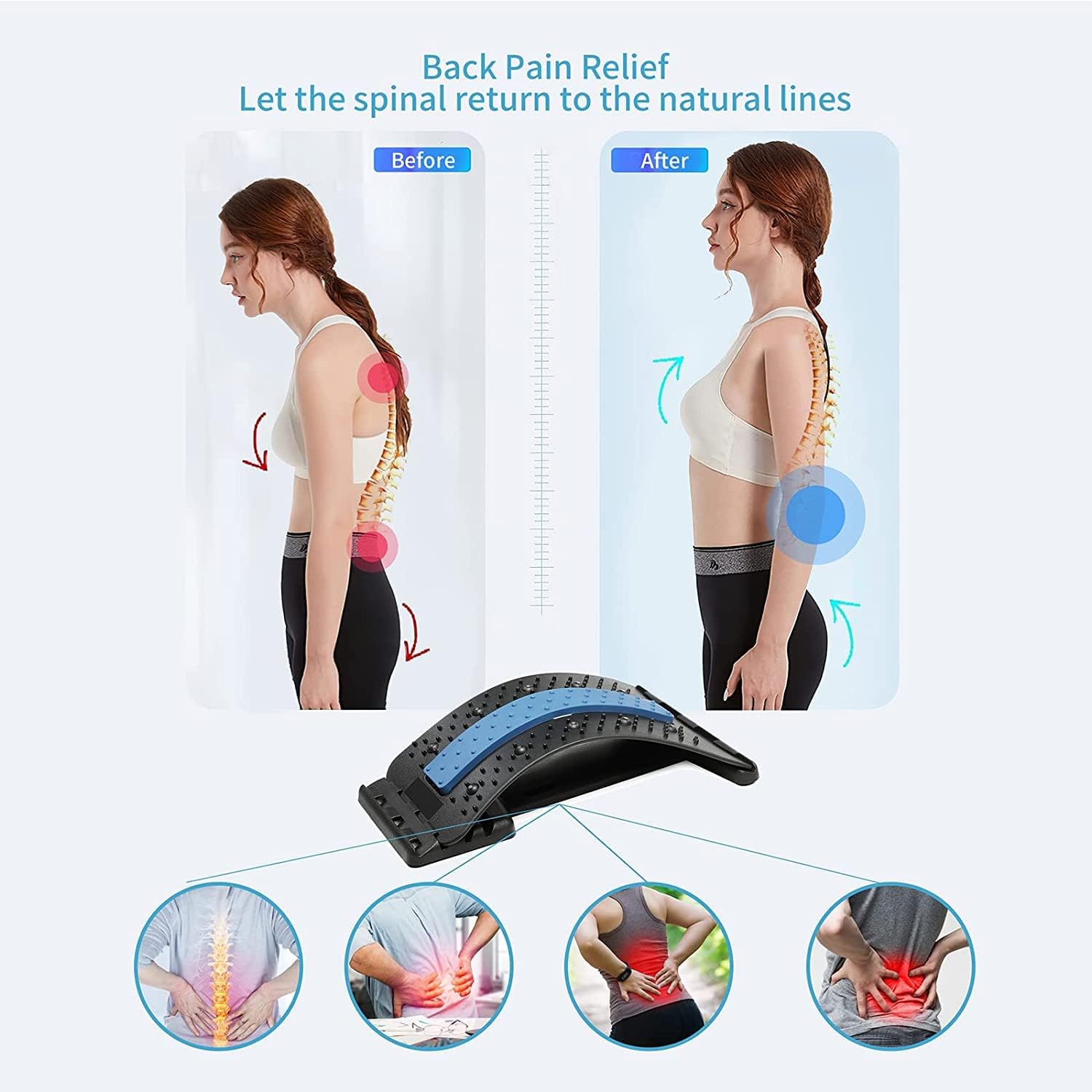 Ejercicios Masajes Para Lumbalgia Lumbalgia Crónica Ventosas Para - Main Image