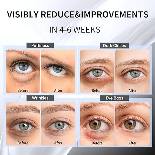 Miniatura 2 de Hicream Advanced Snail Hydrogel Eye Patch 60 parches, máscara de suero de gel, tratamiento debajo de los ojos, forro fino, ojos hinchados,