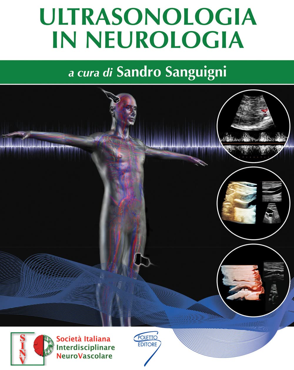 Ultrasonologia In Neurologia - 4