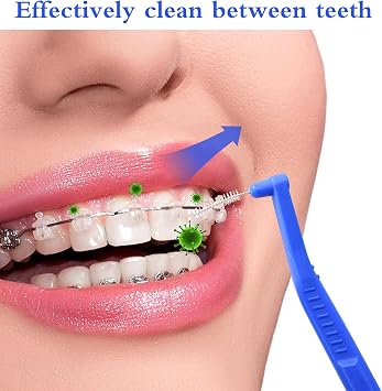 25 Pcs Interdental Angle Brushes,Reusable Dental Cleaners(Blue)