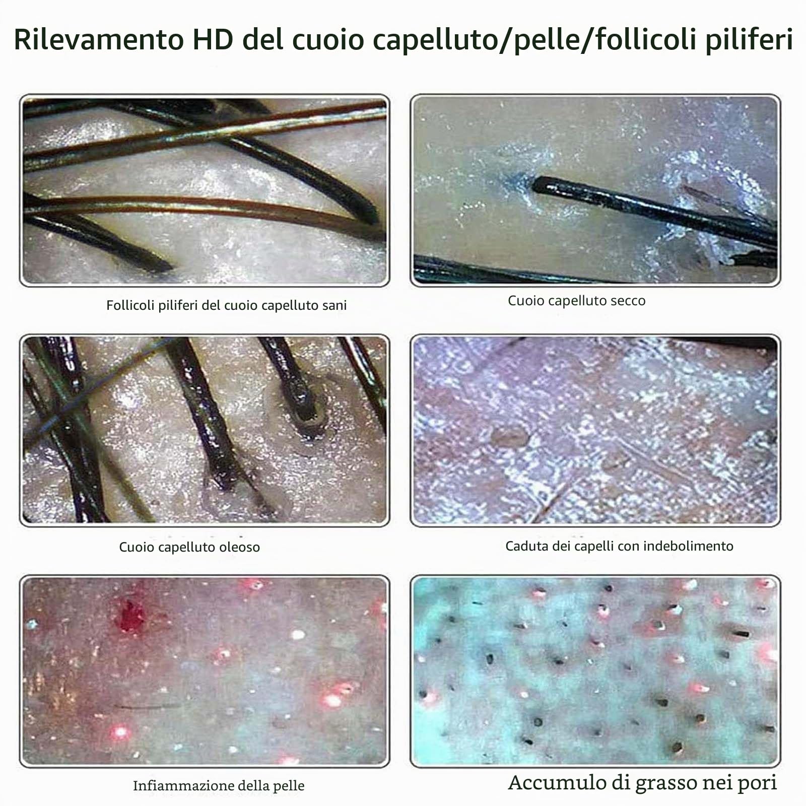 Analizzatore di capelli per diagnosi della pelle - Microscopio digitale da 28 cm per follicoli piliferi del cuoio capelluto e macchina per il rilevamento di capelli e pelle - Strumento per uso