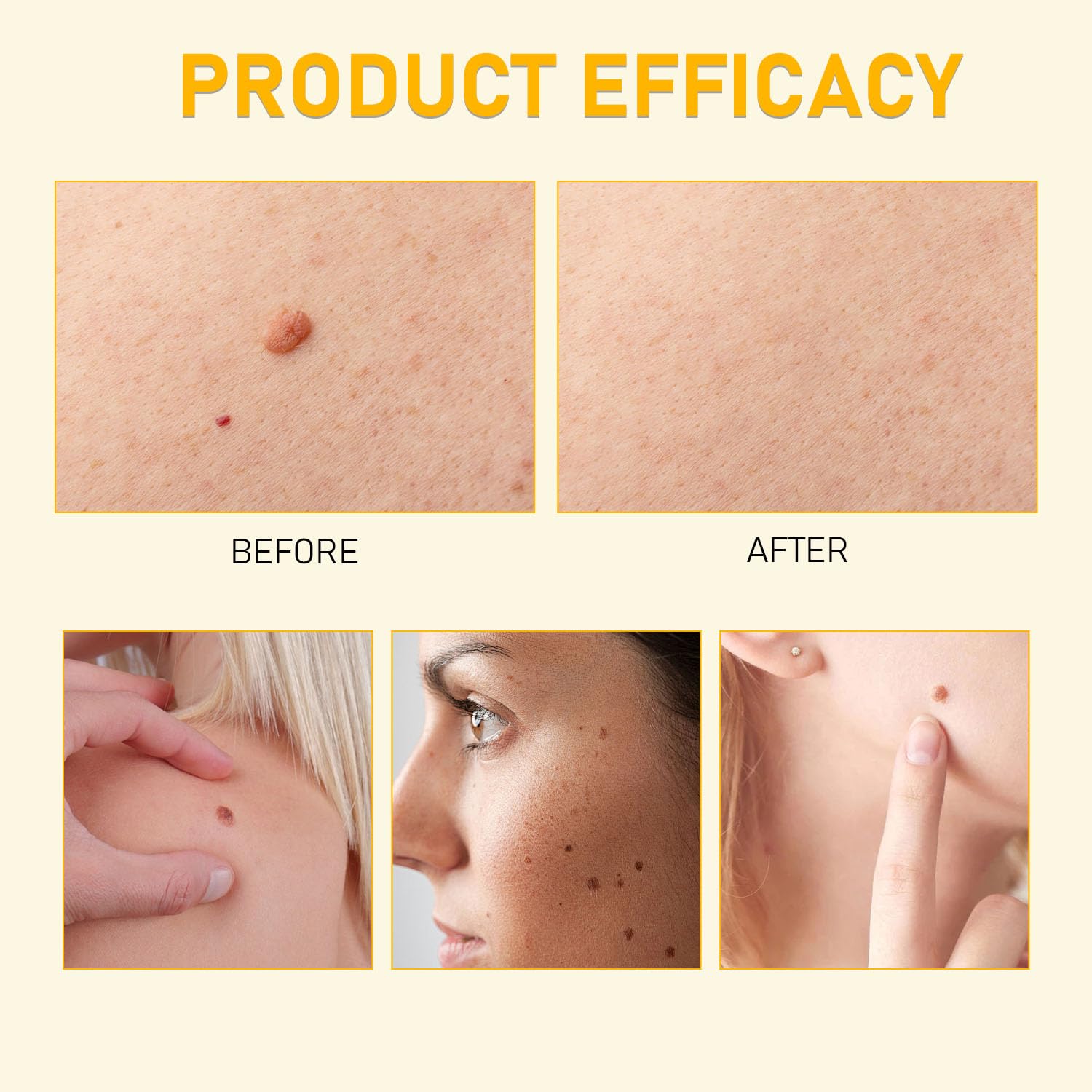 Bee Venom Skin Restoration Cream, Bee Venom Comprehensive Creams, Professional BeeVenom Skins Cream, Advanced Firming & Wrinkle-Reducing Creams,Natural Skins Moisturizer for All Skin Types(2pcs) - Image 5