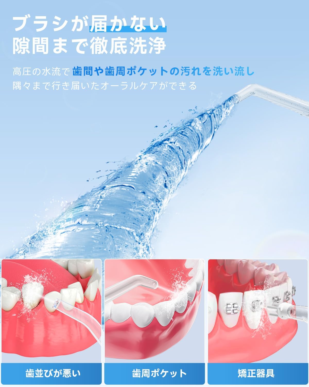 Baanandoジェットウォッシャーの5種類のノズル