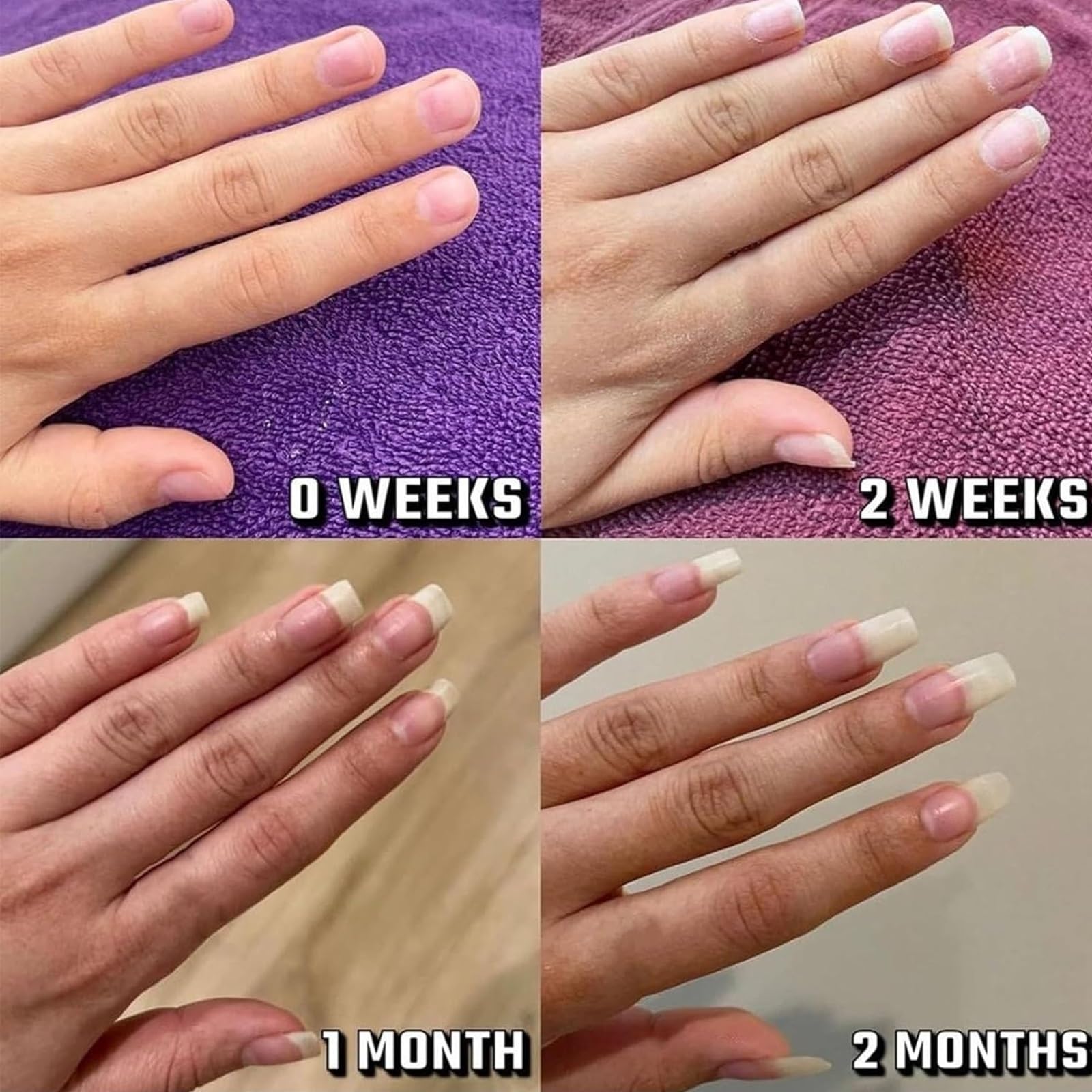 Lyra Cosmetic Nails, Olejek do skórek paznokci, Radiant Nail Growth Oil, Kosmetyczne serum nawilżające, wzmacniające i rozjaśniające pielęgnację paznokci(4pcs)