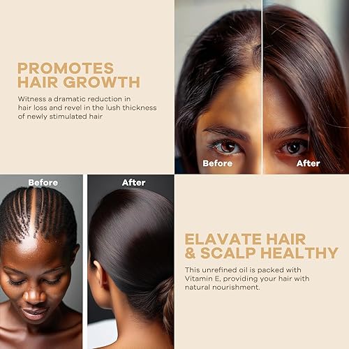 Miniatura 4 de GROSSTY Aceite de batana para el crecimiento del cabello, Dr. Sebi 100% puro crudo orgánico aceite de batana mantequilla tratamiento hidratante