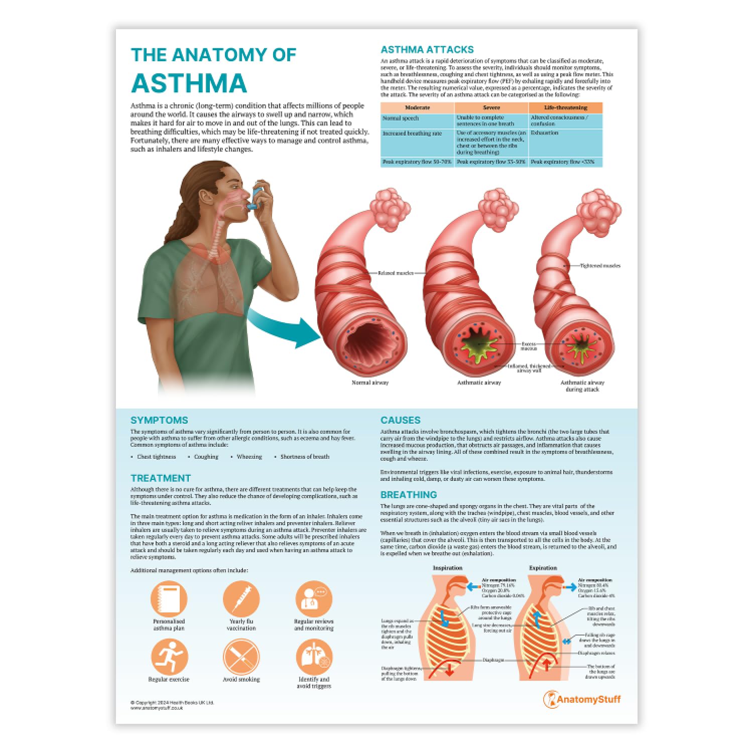 Anatomy Stuff Asthma Anatomystuff The Anatomy Of Poster, 45X60 Cm, 18X24 Inches, Attack Chart, Understanding Wall Diagram