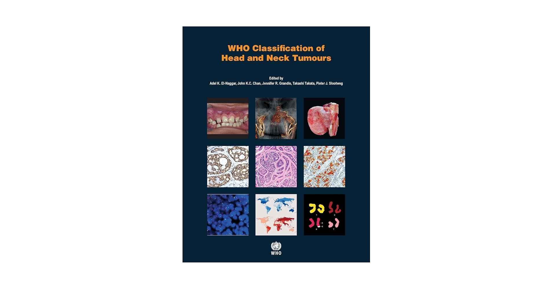 【未開封】WHO Classification of Tumours of En WHO Classification of Tumours of Haematopoietic and Lymphoid