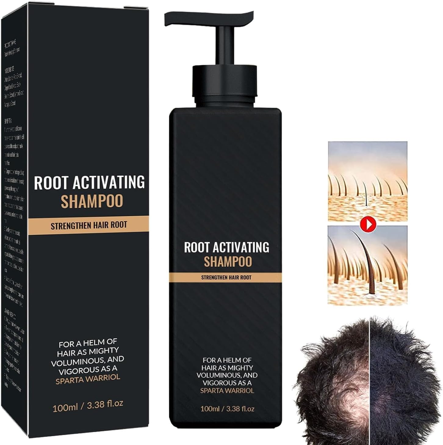 Spartan Shampoo, Spartan Root Activator Shampoo, Spartan Hair Loss Shampoo, Spartan Shampoo Root Activator, Unisex Natural Hair Regrowth Shampoos (1pcs)
