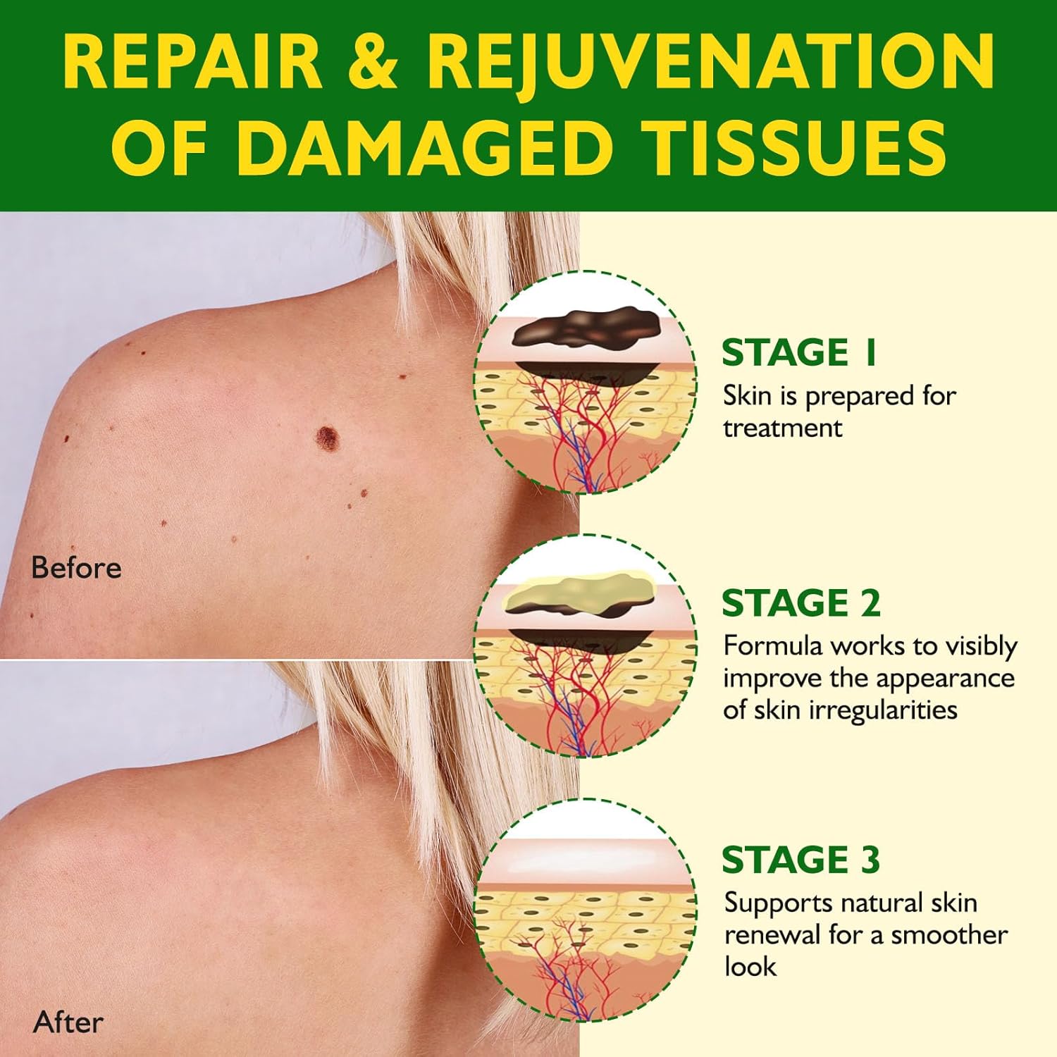 Bee Venom Skin Restoration Cream,Bee Venom Concentrated Cream,Deeply Nourishes the Skins and Reduces Skin Blemishes-Quickly Smoothing and Moisturizes the Skin-120G - Image 7