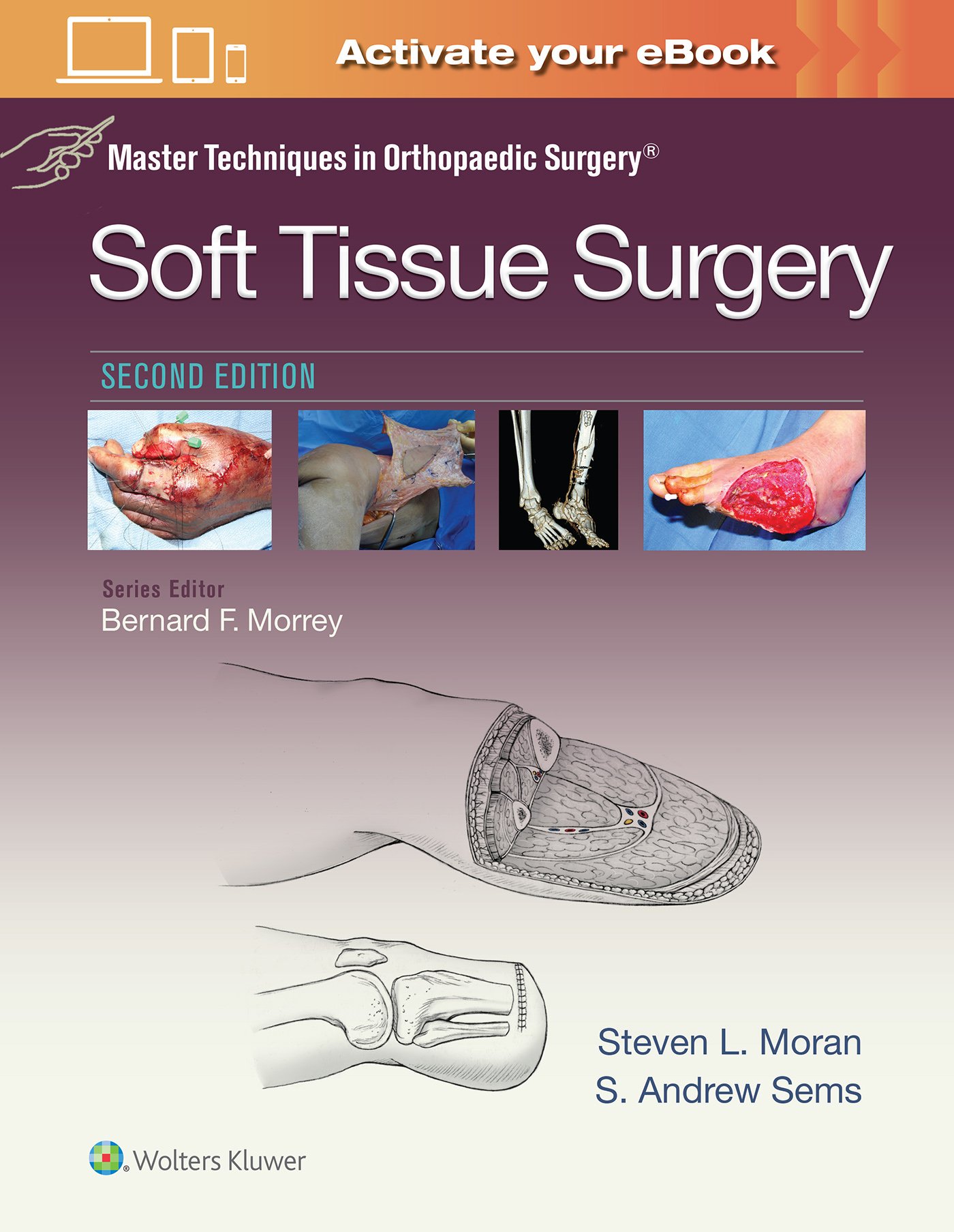 Master Techniques in Orthopaedic Surgery: Soft Tissue Surgery... - 9781496329004