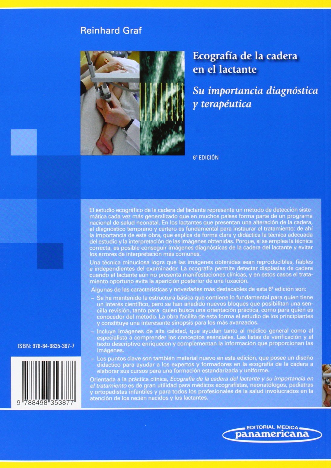 Ecografia de la cadera en el lactante: Su importancia diagnóstica y terapéutica
