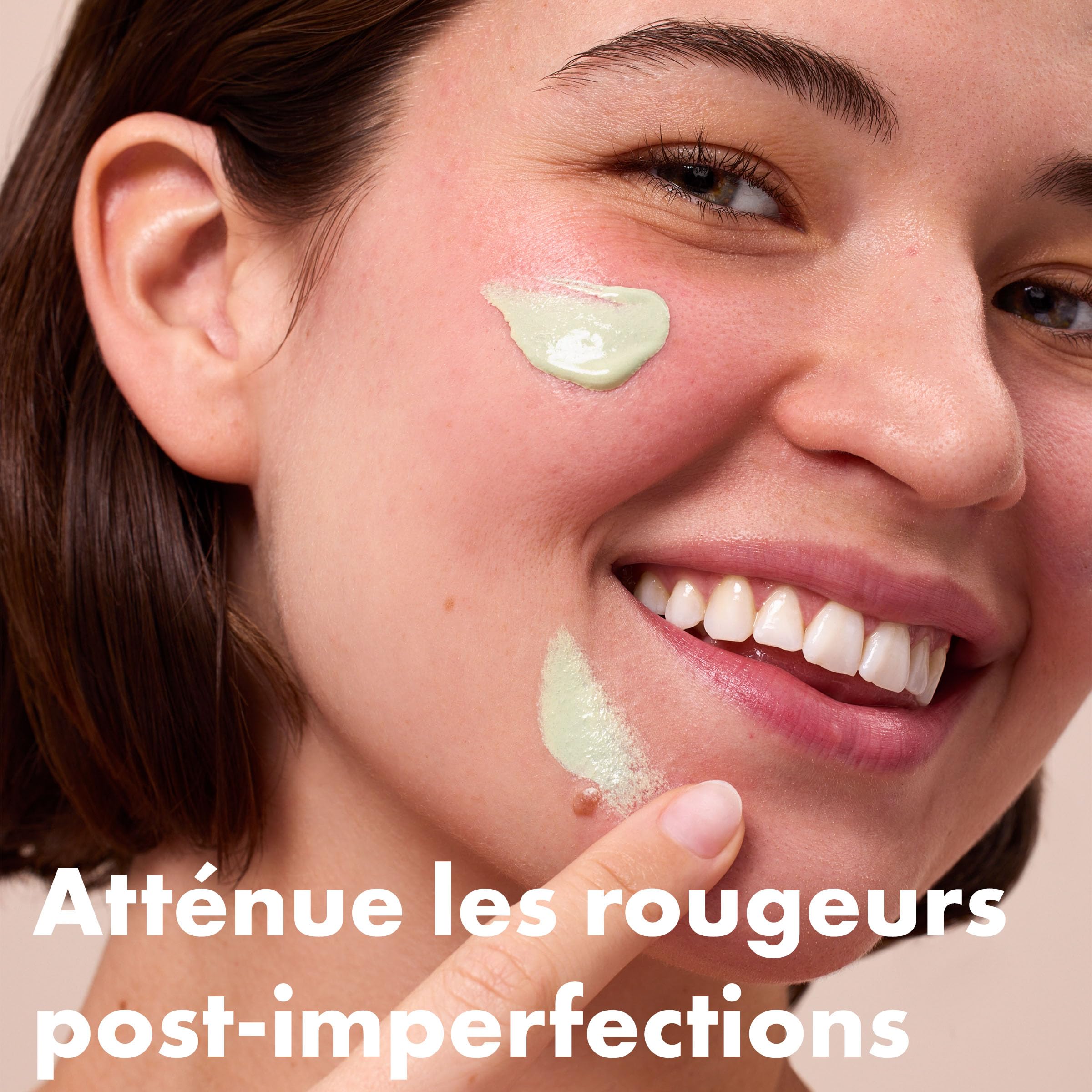 Hero Cosmetics - Rescue Balm Red Correct - Baume Correcteur Anti-Rougeurs - Atténue les rougeurs et marques laissées par lesboutons - 15 mL