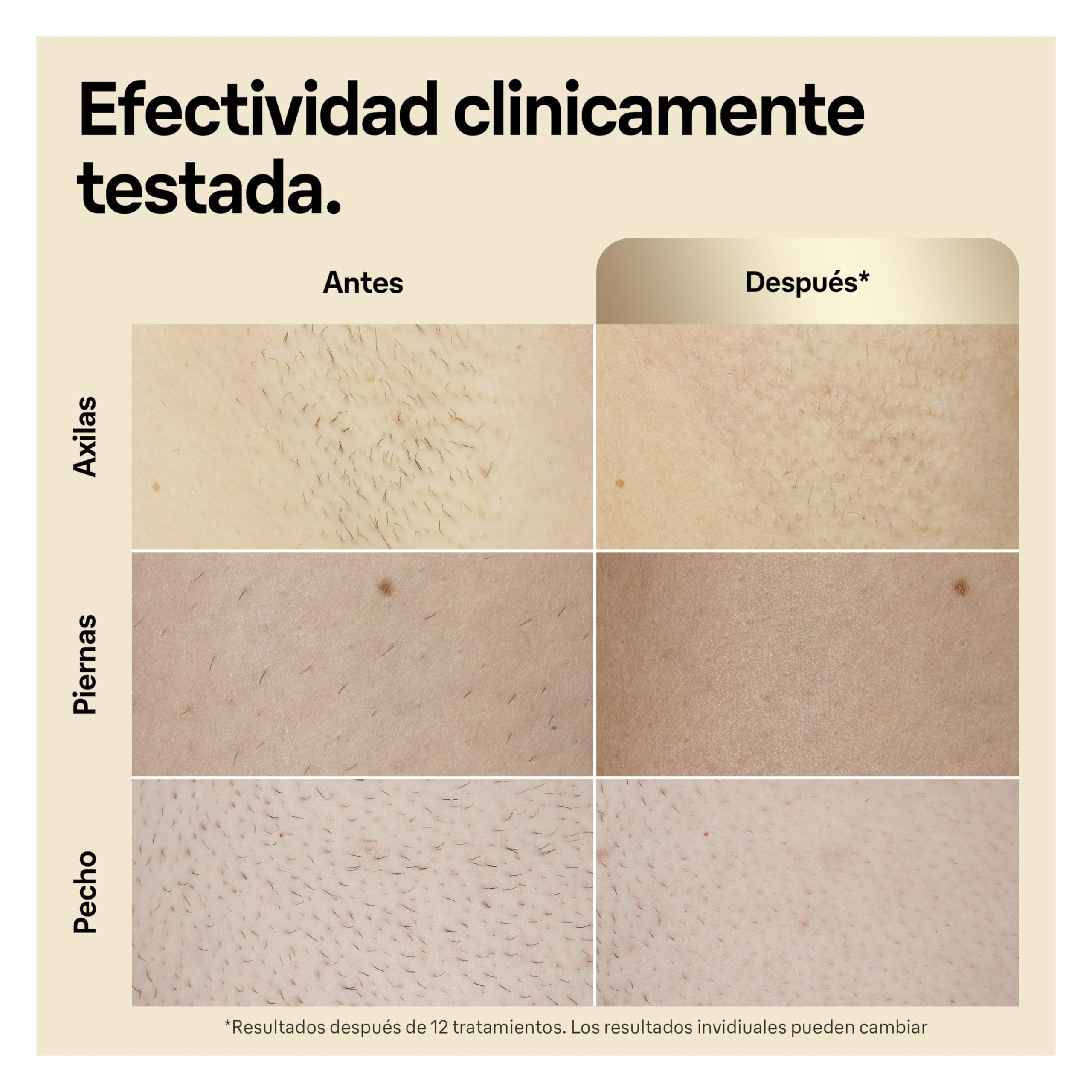 Depiladora Ipl Braun Silk Expert Pro Resultados Reseña Braun Silk