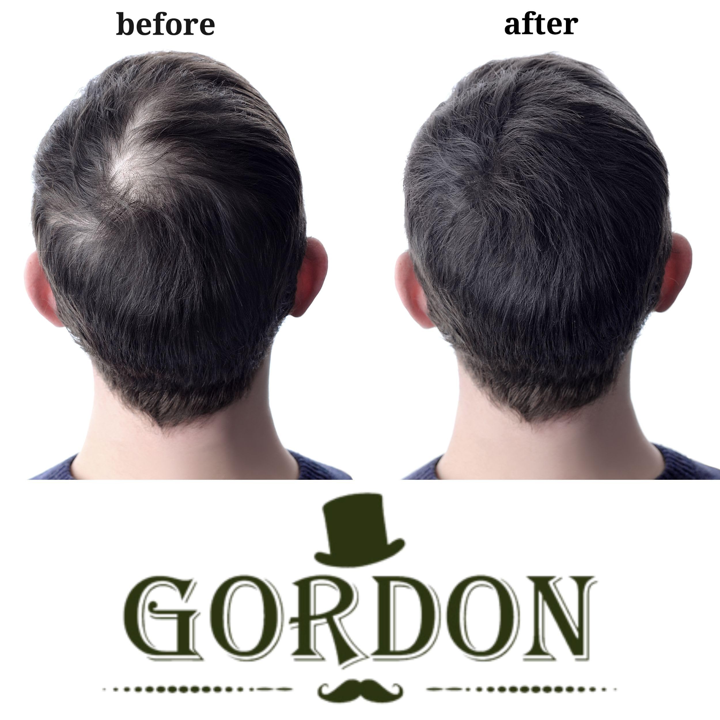 Fibre per capelli Gordon Set 2 Confezioni da 22 Grammi, copertura istantanea per il diradamento. (2 x Castano Scuro Senza Applicatore)