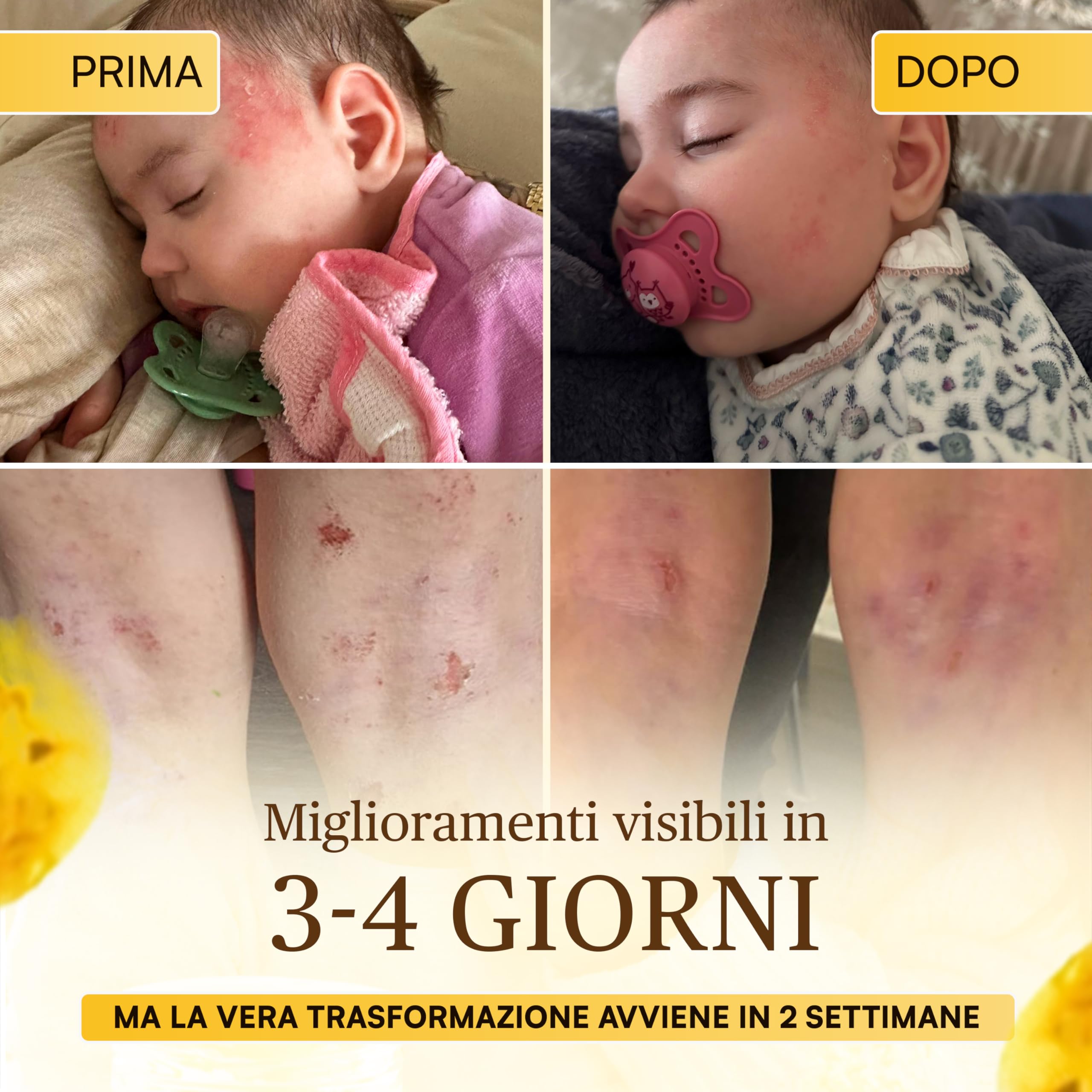 Coccole di Elicriso Crema Bimbi e Adulti Lenitiva senza acqua - Crema Corpo Pelle Sensibile Ultra Concentrata per Dermatite Atopica su Viso, Mani e Corpo - Senza Conservanti con Oli Pregiati, 30 ml