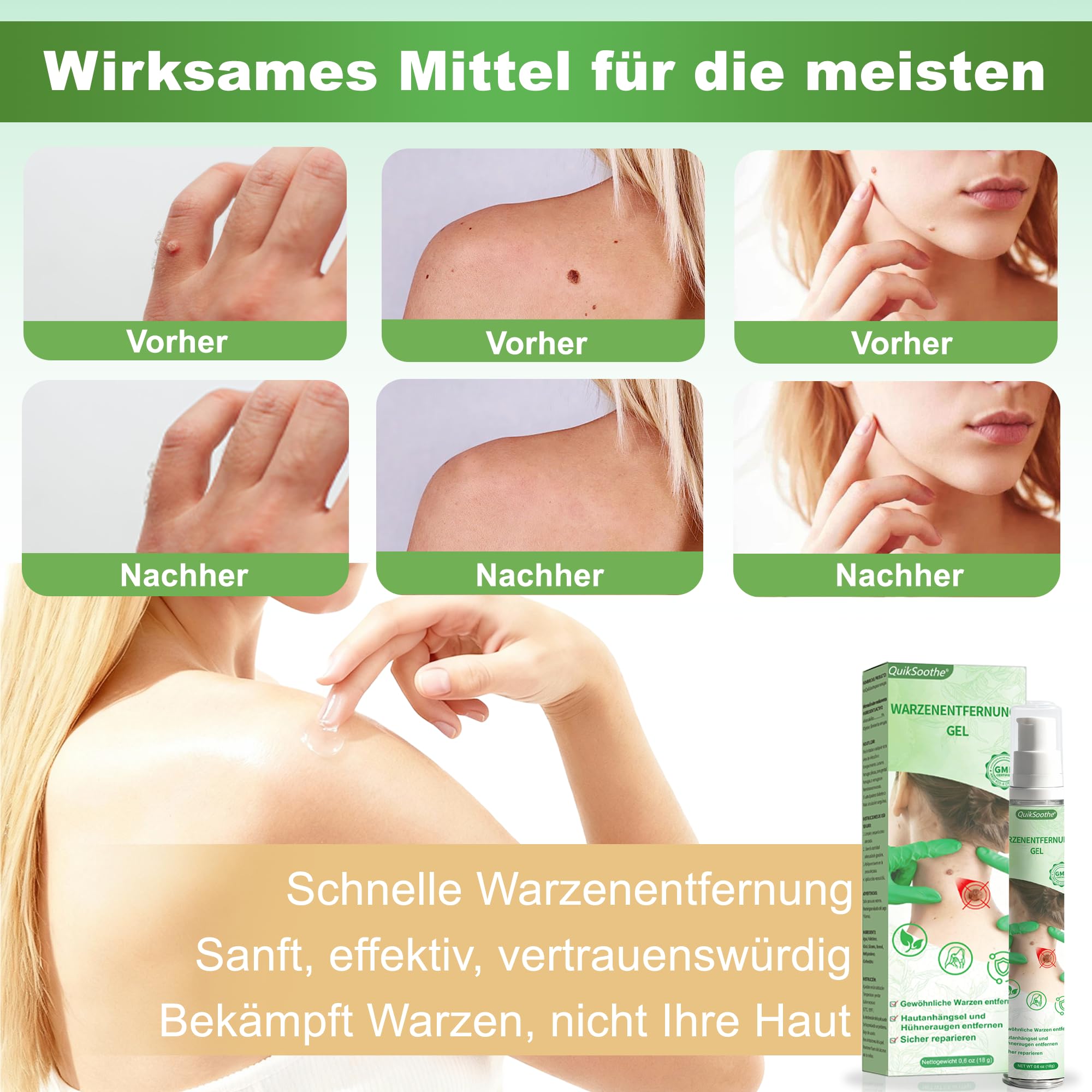 Warzenentfernercreme – geeignet für alle Hauttypen, Sanfte Formel für Körper und Hände (18G)