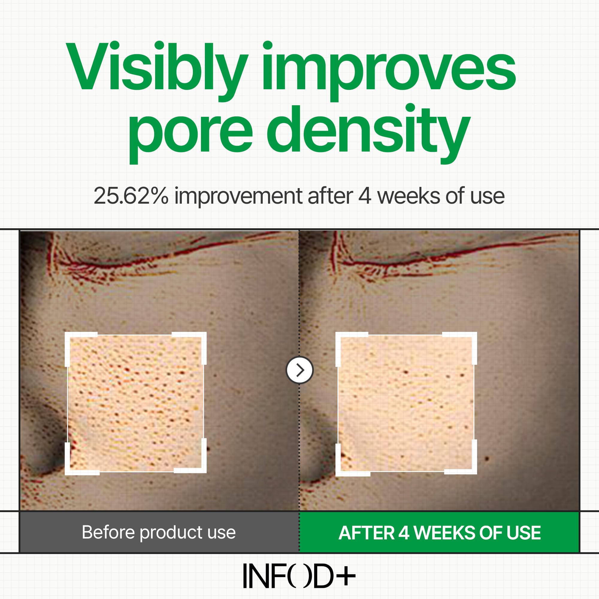 INFODPLUS XCESPI316™ HYDROVITA GEL PAD 70PADS / 160G