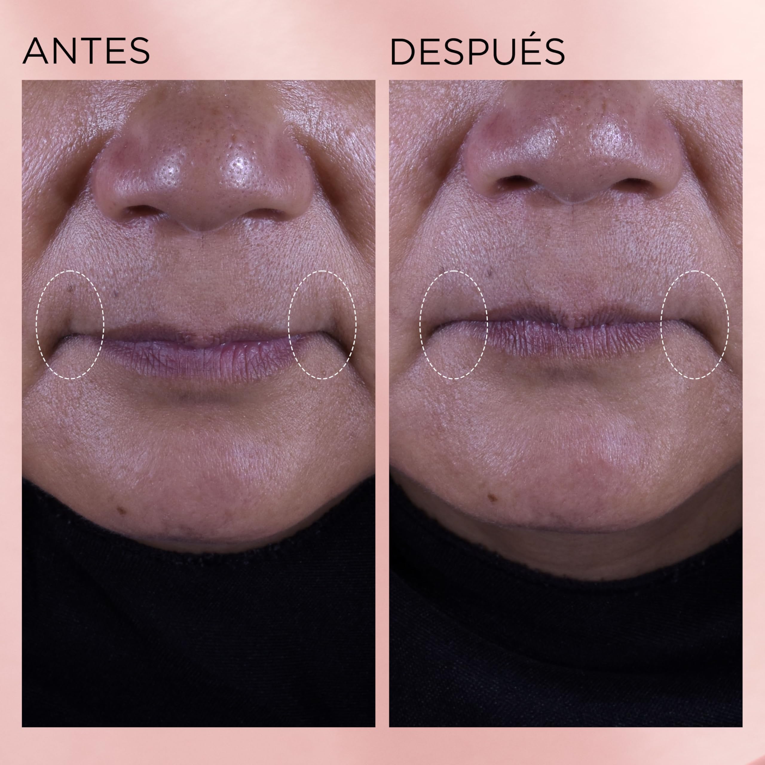 Elizabeth Arden Retinol + HPR Ceramide Crema Renovadora 50 ml | Crema con retinol y ceramidas que ayuda a alisar arrugas y mejorar textura y firmeza.