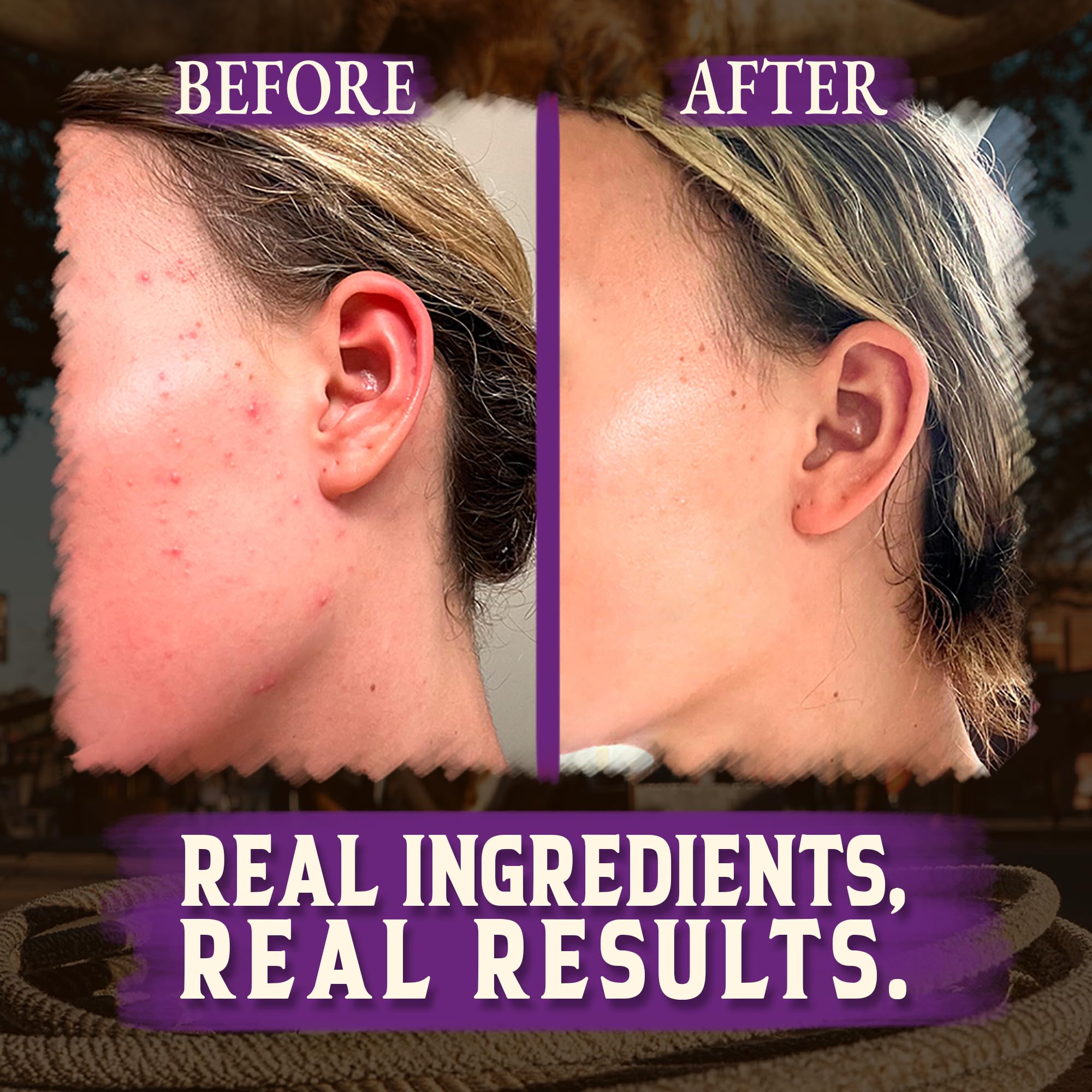Beef Tallow Balm Moisturizer for Skin