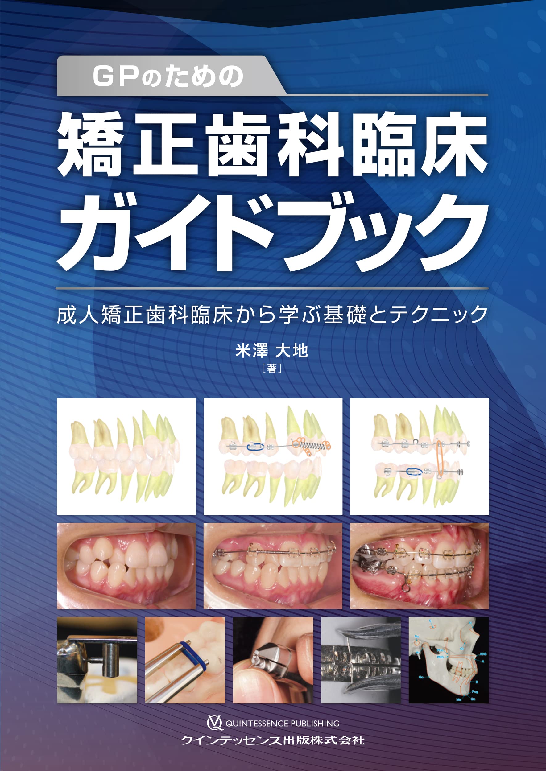 GPのための矯正歯科臨床ガイドブック: 成人矯正歯科臨床から学ぶ基礎と 