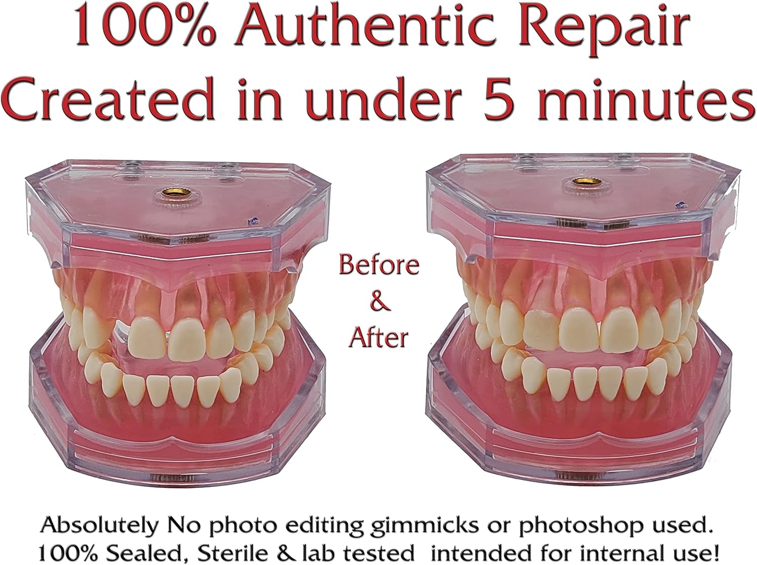 SmileFix Color Matching Dental Repair Kit - Missing or broken tooth or teeth. Gaps or cracks fixed temporary or permanent quick & safe. Regain your confidence and beautiful smile in minutes at home! : Beauty & Personal Care