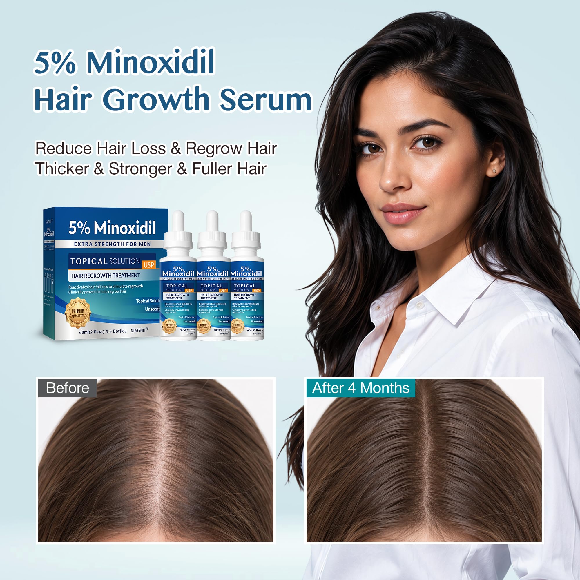 anyone try l carnitine tartrate minoxidil for hair growth forums 5% Men and Women: Extra Strength Beard Regrowth Treatment Serum with Minoxidil and Biotin for Thinning Hair Loss to Grow Thicker Fuller 180ml : Beauty & Suplemento Nutricional Alcachofa Naturcol Dear Klairs BPC-157 Therapy Program:BPC Capsules Therapy